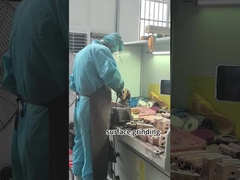 इलेक्ट्रोड बांह